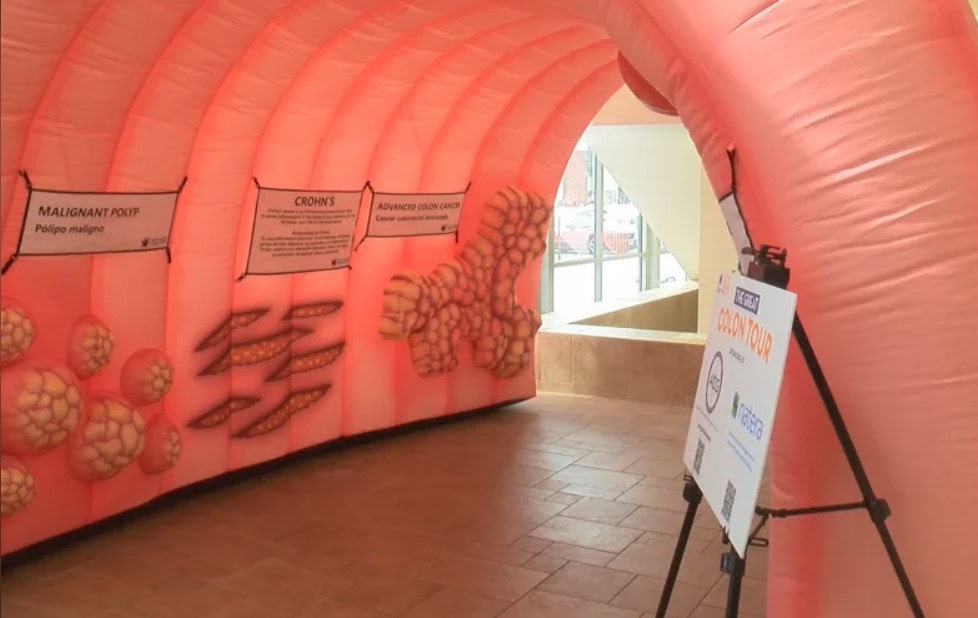 Winona Health Tso Tawm Cov Khoom Siv Loj Loj Rau Kev Paub Txog Kab Mob Cancer Hauv Plab Hnyuv Lub Hlis 2 Colon Interactive Display